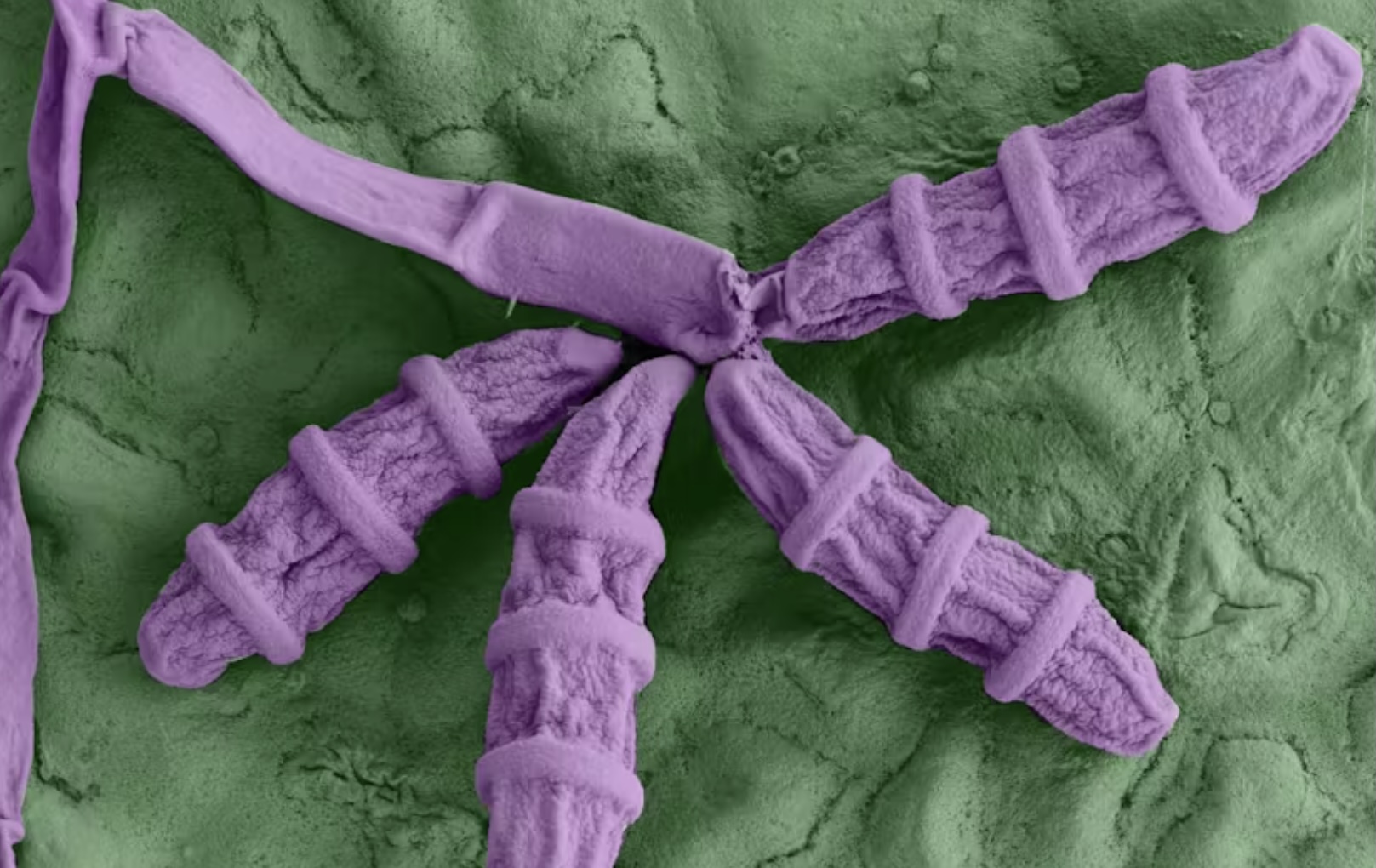 Is there fungi in the sea?